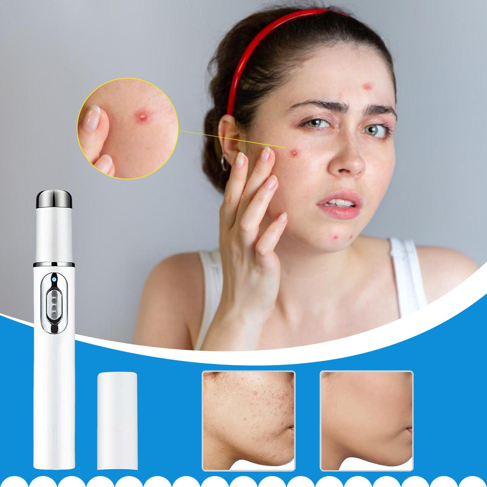 Mole Remover Pen Portable Skin - Women Accessories Combo 评论和价格
